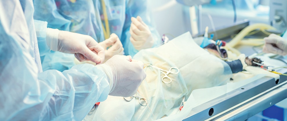 LAPAROSCOPY
