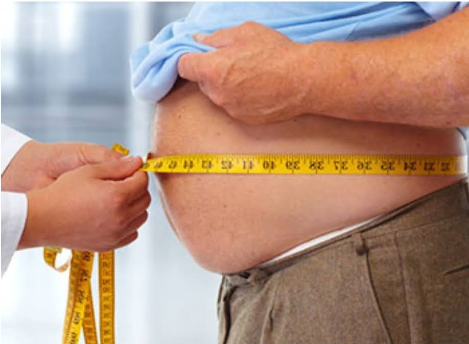 Obesity Surgery