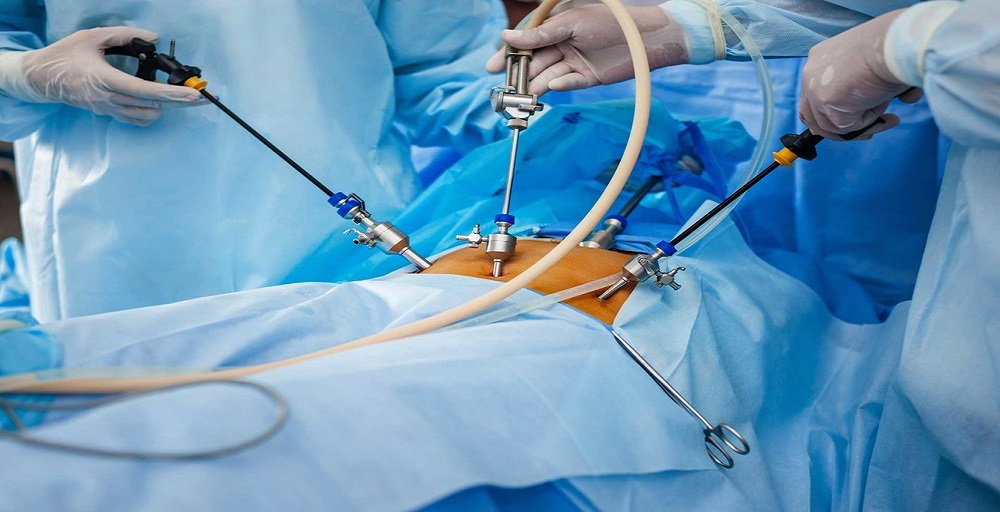 NON INVASIVE METHODS (ENDDOSCOPIC PROCEDURES)